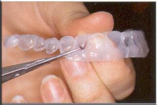 Whitening Tray